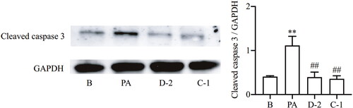 Figure 6. Compounds D-2 and C-1 inhibited caspase 3 activation. Min6 β cells were incubated with D-2 and C-1 at concentration of 10 μmol/L and then exposed to PA (300 μmol/L) for 12 h. Protein expression of cleaved caspase 3 was measured by Western blot. **p < 0.01 vs control cells; ##p < 0.01 vs PA-treated cells. Data were presented as mean ± SD (n = 4).