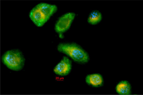 Figure S2 Image showing nanocarrier colocalization with acidic organelles.
