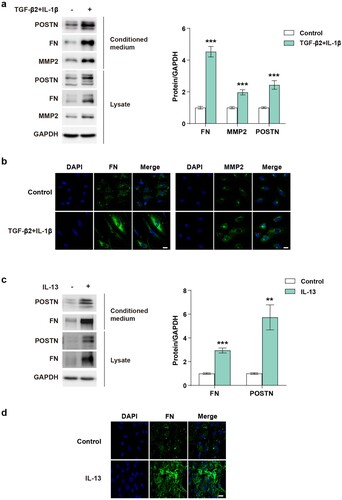 Figure 2. POSTN expression is increased in lysates and conditioned medium in PAECs stimulated with PAH-related stimuli.: a, Protein expression and b, Immunostaining images of FN and MMP2 in PAECs stimulated with of TGF-β2 (10 ng/mL) and IL-1β (1 ng/mL) for 5 days. Scale bar = 20 µm. c, Protein expression and d, Immunostaining images of FN in PAECs stimulated with IL-13 (10 ng/mL) for 4 days. Scale bar = 20 µm. ** P < 0.01, *** P < 0.001 determined by the unpaired two-tailed Student’s t-test. Error bars represent S.E.M.