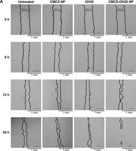 Figure 4 In vitro HaCaT cell migration assays.Notes: (A) Effects of untreated, CMCS NP, OH30, and CMCS-OH30 NP were assessed by microscope images. (B) Cell migration rates of each group were expressed as percentage of initial blank area. Statistical significance compared with other groups (mean ± SD; n = 4; *p < 0.05 and **p < 0.01).Abbreviation: CMCS-OH30 NP, carboxymethyl chitosan nanoparticles.