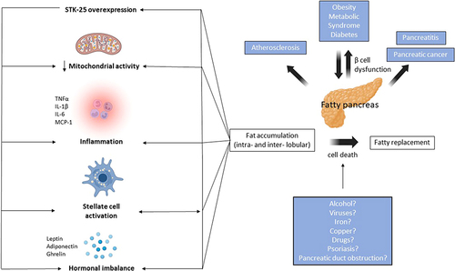 Figure 1 Pathogenetic mechanisms behind fatty pancreas. The main pathogenetic mechanism behind non-alcoholic fatty pancreas diseases (NAFPD) is fatty accumulation (intra- or inter- lobular), followed by fatty replacement and, ultimately, β cell dysfunction. The main risk factors associated with NAFPD are obesity and metabolic syndrome (including dyslipidemia), while alcohol, viruses, iron deposition, drugs, gut hormones, psoriasis and pancreatic duct obstruction represent potential secondary;hits’ which participate in cell death and replacement of pancreatic tissue with fat. Mechanisms associated with fat accumulation include reduction in mitochondrial activity, inflammatory cell infiltration with production of inflammatory cytokines (eg TNFα, ΙL-1β, IL-6, MCP-1), activation of stellate cells, hormonal imbalance (with perturbed leptin and adiponectin levels), as well as STK-25 pathway overexpression, which further exacerbates all the aforementioned mechanisms. NAFPD, in turn, is associated with various conditions including diabetes, pancreatitis, pancreatic cancer, as well as atherosclerosis.