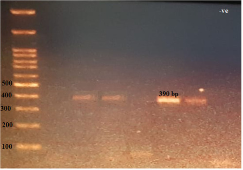 Figure 5 The 390-bp PCR amplification of blaVIM gene among P. aeruginosa isolates. First lane, DNA ladder, 100-bp DNA size marker; −ve, negative control.