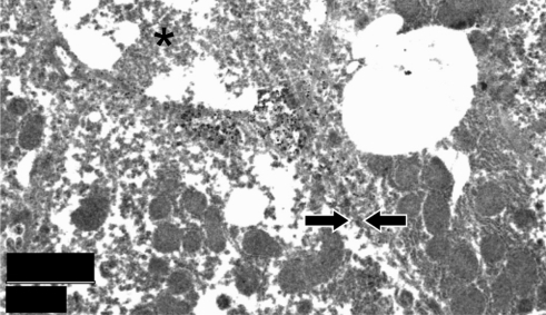 Figure 7 Ultrastructural aspect of liver from an implant-bearing animal in the late phase of observation period. *Transected biliary canalicule flanked by two hepatocytes, the cell borders of which (arrows) are not readily identified due to poor specimen preservation. Regular aspect of mitochondria is a good indicator of lack of metabolic stress, as frequently seen in storage disorders. Original magnification is indicated by scale bar.