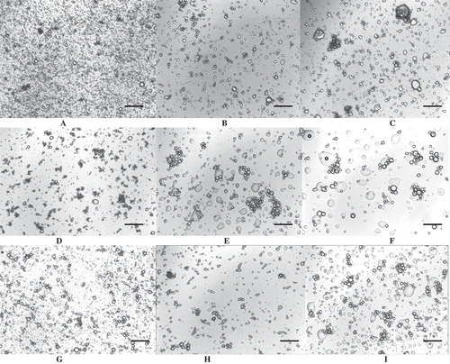 FIGURE 4 Light microscopy images of pumpkin seed extract emulsions after 72 h storage. A: DWES emulsion (0 M NaCl); B: SES emulsion (0 M NaCl); C: AES emulsion (0 M NaCl); D: DWES emulsion (0.5 M NaCl); E: SES emulsion (0.5 M NaCl); F: AES emulsion (0.5 M NaCl); G: DWES emulsion (1 M NaCl); H: SES emulsion (1 M NaCl); I: AES emulsion (1 M NaCl). The black bar represents a size of 150 µm.