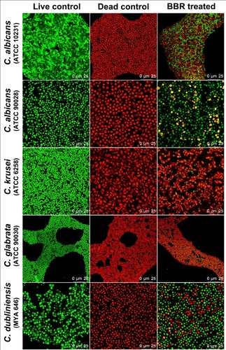 Figure 6 Evaluation of the inhibitory effects of berberine against mature Candida biofilms by CLSM. Live yeasts with intact cell membranes were stained fluorescent green, whereas dead yeasts with damaged membranes were stained fluorescent red. The gross number of dead Candida cells in the berberine-treated groups increased significantly compared with that in the live control groups, especially for C. krusei and C. glabrata.