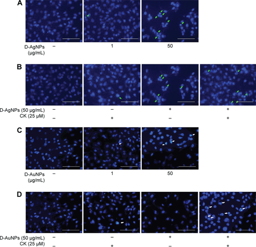 Figure S1 Cell apoptosis determined by Hoechst 33258 staining.Notes: Morphological changes in A549 cells treated with (A) D-AgNPs, (B) CK combination with D-AgNPs, (C) D-AuNPs, and (D) CK combination with D-AuNPs for 48 hours and stained with Hoechst 33258 dye. A synergistic effect induced apoptosis and morphological changes in A549 cells. Apoptotic cells are indicated with an arrow. The magnification scale is 400×. Scale bars are 10 µm.Abbreviations: CK, compound K; D-AgNPs, Dendropanax silver nanoparticles; D-AuNPs, Dendropanax gold nanoparticles.