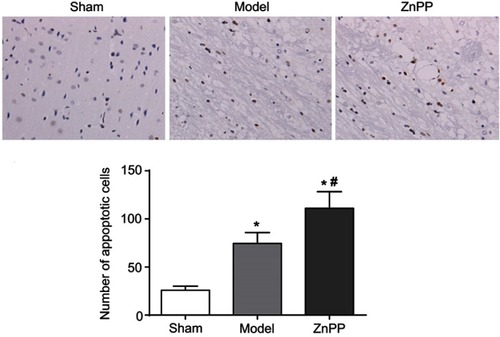 Figure 4 Changes of neuronal apoptosis in brain tissue of rats. *p<0.05, compared with the sham group. #p<0.05, compared with the model group. The positive cells were stained brown.