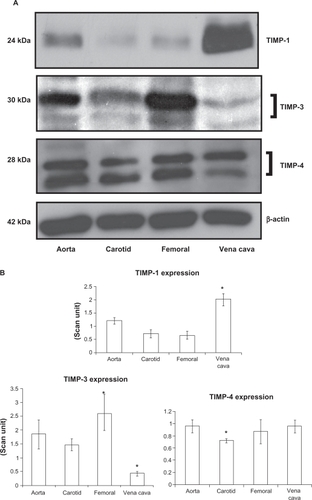 Figure 5 Differential expression of TIMPs in vascular beds. A) Western blot analysis. B) Bar graphs of scanned intensity values. The TIMP-1 protein was detected at higher levels in the vena cava, whereas TIMP-3 was found at lower levels compared with other vessels. TIMP-4 was detected at lower levels in the carotid artery. The bar diagram shows densitometric analyses of TIMP protein.