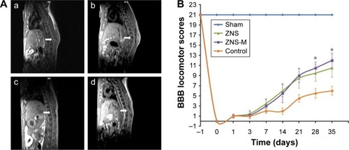 Figure 8 Functional analysis.Notes: (A) MRI images of SCI rats after 4 weeks: (a) sham group, (b) free ZNS group, (c) ZNS-M group and (d) control. Arrows indicate the site of injury. (B) BBB scores of each treated group. *P<0.05.Abbreviations: MRI, magnetic resonance imaging; SCI, spinal cord injury; BBB, Basso–Beattie–Bresnahan; ZNS, zonisamide; ZNS-M, zonisamide micelles.