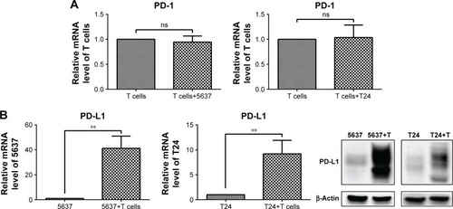 Figure 7 PD-1 expression in T cells and PD-L1 expression in bladder cancer cells under co-culture conditions.