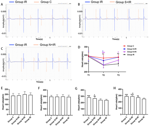 Figure 3 Effects of CFs-Exo and Sev-CFs-Exo on heart rates. Representative biphasic electrograms from a single channel were obtained from isolated hearts in the control condition (A) and the presence of Sev-CFs-Exo (B) and CFs-Exo (C). The heart rates in the four groups: reperfusion vs balanced perfusion (D), *group IR, #(purple) group N+IR, *(blue) group S+IR. Comparison of heart rates in the four groups at T0 (E), T1 (F), T2 (G), and T3 (H),*vs group IR, #vs group N+IR. Data from n = 8 hearts. **P<0.01, *** or ###P<0.001.