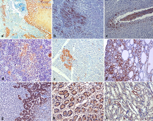 Figure 3. The immunolocalization of FMDV antigen in various tissues of FMDV affected calves showing a) tongue showing distinct intense cytoplasmic immunostaining in the stratum basal and spinosum layer of cattle calf. The density of reaction is much higher in the stratum basal layer, IHC, X100. b) Distribution of FMDV antigen diffusely in multifocal manner in the necrosed cardiac muscle fibers of buffalo calf, IHC, X100. c) The macrophages infiltrating the tonsillar crypt epithelium showing the presence of FMDV antigen, IHC, X100. Note the presence of viral antigen in the necrotic cellular debris. d) Thymus showing cytoplasmic immunoreactivity for FMDV antigen in hassall’s corpuscles of cattle calf, IHC, X200. e) Pancreas showing high amount of FMDV antigen in the islets of Langerhans of buffalo calf. Note the moderate cytoplasmic immunoreactivity in the few pancreatic acinar cells, IHC, X100. f) Thyroid showing intense immunostaining for FMDV antigen in the follicular cells of cattle calf, IHC, X100. g) Adrenal gland showing diffuse granular strong cytoplasmic staining in zona reticularis layer of the adrenal cortex of cattle calf, X200. h) The small intestinal epithelial cells as well as the intraepithelial inflammatory cells showed the presence of FMDV antigen of buffalo calf, IHC, X100. i) The tubular epithelial cells of the kidney in cattle calf showing cytoplasmic immunopositivity for FMDV antigen, IHC, X100.