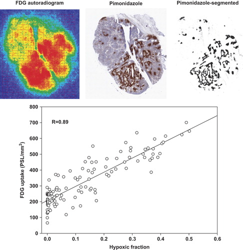 Figure 2. Top panel: Example of a C3H mammary carcinoma tumor showing corresponding FDG autoradiogram, Pimonidazole staining and Pimonidazole-segmented image. Bottom panel: A scattergram depicting the relationship between hypoxia and FDG retention is shown. There is a clear spatial linkage (R: correlation coefficients) between cellular FDG uptake and hypoxia, showing that the Pasteur Effect is present in vivo.