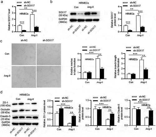 Figure 1. SOX17 knockdown inhibits angiogenesis and upregulates protein levels of tight junctions in Ang-II-treated HRMECs. (a-b) After transfection of sh-NC or sh-SOX17, SOX17 mRNA and protein levels in HRMECs with or without Ang-II treatment were detected by RT-qPCR and western blotting, respectively. (c) After transfection of sh-NC or sh-SOX17, angiogenesis of HRMECs with or without Ang-II treatment was examined by tube formation assays. (D) the protein levels of tight junctions (ZO-1, Occludin and Claudin-5) in HRMECs transfected with sh-NC/sh-SOX17 and treated with or without Ang-II were tested by western blotting. ** p <0.01, *** p <0.001.