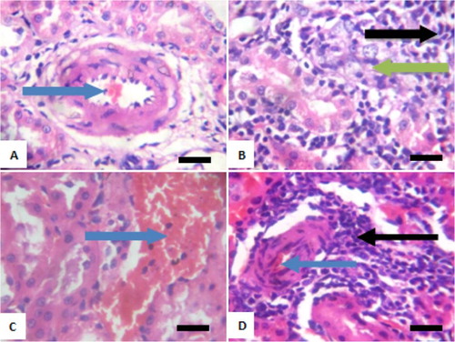 Figure 7. Photomicrograph showing kidney of rats exposed to sodium arsenite orally for 4 weeks. (A) Control shows focal hemorrhagic lesion (blue arrow); (B) 10 mg/kg NaAsO2 with peritubular infiltration by inflammatory cells (black arrow) and mild tubular necrosis (green arrow); (C) 20 mg/kg NaAsO2 showing congestion of vessel (blue arrow) and (D) 40 mg/kg NaAsO2 showing congestion of vessels (blue arrow) and peritubular infiltration by inflammatory cells (black arrow). Scale bar (for A, B, C and D) = 2.15 × 2.79 mm. Plates are stained with H and E stains and viewed with 100 objectives.
