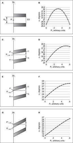 Figure 3 Four sets of two adjacent spinous processes and their corresponding plots are depicted.