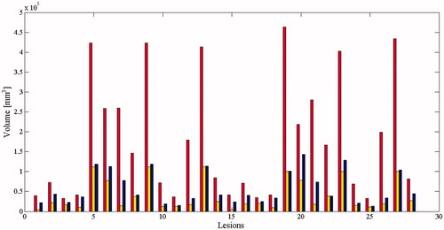 Figure 5. Comparison of the ablation volumes obtained using the combined treatment (red bars), ablation volumes which would have been obtained using stand-alone MWA (blue bars), and the pretreatment volumes of the nodules (yellow bars).