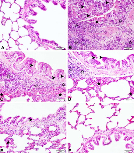 Figure 3. Histopathological examination of lungs of septic rats (magnification 40×). (A) Lung tissue of the control group with normal histological appearance (H&E, bar = 50 µm). (B) Lung tissues of the CLP group with very severe peribronchiolar cell infiltration (empty stars), very severe desquamation in bronchiolar epithelium (arrowheads), and very severe venous hyperemia (H&E, bar = 50 µm). (C) Lung tissue of the SBR1 group with severe peribronchiolar cell infiltration (empty stars), severe interalveolar septum thickening (black stars), moderate desquamation of bronchial epithelium (arrow heads), and severe venous hyperemia (H&E, bar = 50 µm). (D) Lung tissue of the SBR2 group with moderate peribronchiolar cell infiltration (empty stars), moderate interalveolar septum thickening (black stars), moderate desquamation of bronchial epithelium (arrow heads), and moderate venous hyperemia (H&E, bar = 50 µm). (E) Lung tissue of the SBR3 group with mild interalveolar septum thickening (black star), mild desquamation of bronchial epithelium (arrow head), and moderate venous hyperemia (H&E, bar = 50 µm). (F) Lung tissue of the SBR group with normal histological appearance (H&E, bar = 50 µm).