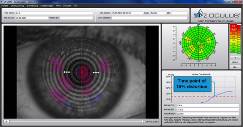 Figure 3 Screenshot of the analyzing software (LEFT: purple segments = objectively detected, blue segments = added by investigator, RIGHT wettability map and function segments over time).