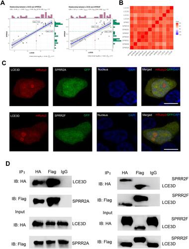 Figure 5 The interaction of between SPRR and LCE. (A) The correlation between LCE3D and SPRR2. (B) The correlation between LCE and SPRR. (C) SPRR2 proteins colocalize with LCE3D upon co-expression in 293T cells. Nuclei were stained using 4′,6-diamidino-2-phenylindole (DAPI). Scale bar represents 10 μm. (D) Immunoassay of lysates of 293T cells transfected with plasmids encoding LCE3D and SPRR2A; LCE3D and SPRR2F, followed by immunoprecipitation (IP) with anti-HA, anti-Flag or the control antibody immunoglobulin G (IgG) and immunoblot analysis (IB) with anti-HA or anti-Flag.