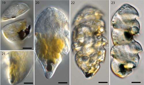 Figs 19–23. Live cells of Nematodinium parvum in different stages of mitotic division (Nomarski interference contrast).