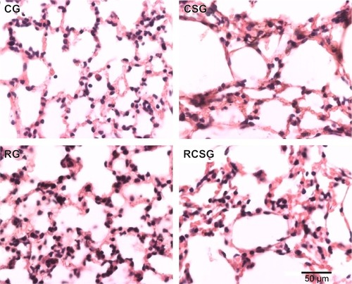 Figure 4 Photomicrographs of lung sections stained with hematoxylin and eosin.
