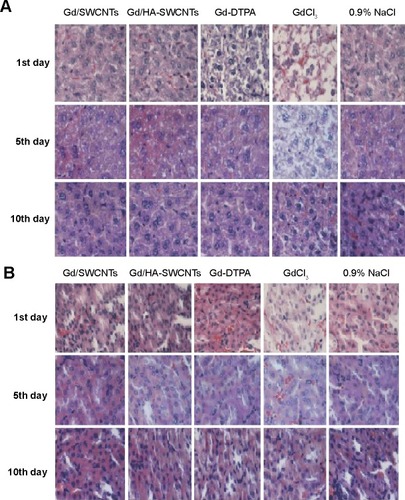 Figure 8 Histologic assessments of liver (A) and kidney (B) with H&E staining in BALB/c mice.Abbreviations: Gd-DTPA, gadolinium (III)-diethylenediaminepentaacetic acid; Gd/HA-SWCNTs, gadolinium/hyaluronic acid-functionalized single-walled carbon nanotubes; Gd/SWCNTs, gadolinium/single-walled carbon nanotubes; H&E, hematoxylin–eosin.