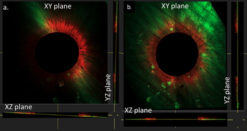 Figure 1. Confocal images loaded into image analysis software (Imaris). Sections of the 3D stack are visualized within the xy, xz and yz planes before (a) and after (b) the correction of parallelism via the oblique slicer tool of Imaris.