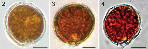 Figs 2–4. Light microscopy images. Fig. 2. Coolia malayensis (strain UNR-02). Fig. 3. Coolia tropicalis (strain UNR-28). Fig. 4. Coolia cf. canariensis phylogroup II (strain UNR-25). Scale bars: 10 µm.