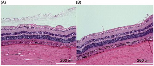 Figure 4. The left panel was from the control eye and the right panel from the study eye. Both sections were from similar location in relation to the visual streak. The structure of the retina appeared normal and comparable though the section from the control eye may be closer to medullary ray, showing more radiating myelinated nerve fibers on the inner surface of the retina. The cortical vitreous collagen can be seen in the vitreous near the retina of the control eye. The white bar =200 µm.