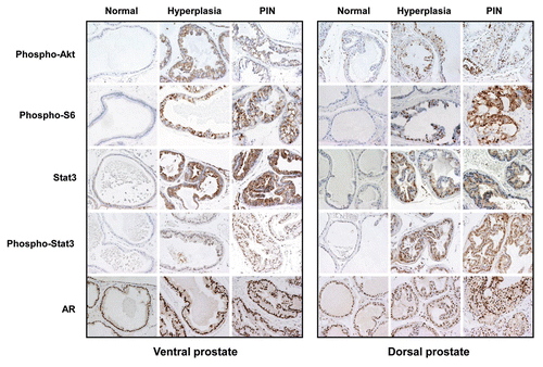 Figure 4 Immunohistochemical analysis of signaling markers in prostates from PB-PKCε mice. Paraffin-embedded prostate tissue sections from 12 month old wild-type or PB-PKCε mice were subject to IHC for the signaling markers indicated in the figure. Representative figures are shown. All microphotographs are 20x magnification.