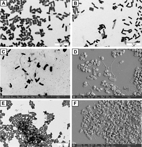 Figure 9 Representative, negatively stained TEM and sputter coated with gold, micrographs of the interaction of glyconanotubes I and II with E. coli strains ORN178 and ORN208.Notes: (A) TEM micrograph of E. coli strain ORN178 alone. (B) TEM micrograph of E. coli strain ORN208 alone. (C) TEM micrograph of the lactose-coated glyconanotube II incubated with the E. coli strain ORN178. (D) SEM micrograph of sputter coated with gold of glyconanotube II incubated with E. coli strain ORN178. (E) TEM micrograph of the mannose-coated glyconanotube I incubated with the E. coli strain ORN178. (F) SEM micrograph of sputter coated with gold of glyconanotube I incubated with E. coli strain ORN178. For conditions, see “Materials and methods” section in the text. Size bars are shown.Abbreviations: TEM, transmission electronic microscopy; SWCNTs, single-walled carbon nanotubes; E. coli, Escherichia coli; SEM, scanning electronic microscopy.