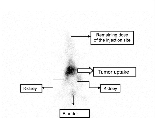 Figure 4. SPECT imaging of Balb/c nude mouse inducted with xenograft cancer model in the back.