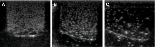 Figure 10 Representative in vitro ultrasonic images.Notes: (A) The nanobubbles under high-frequency diagnostic ultrasound in agarose mold. (B) Pre-destroyed and (C) post-destroyed of the nanobubbles upon high frequency ultrasound exposure.