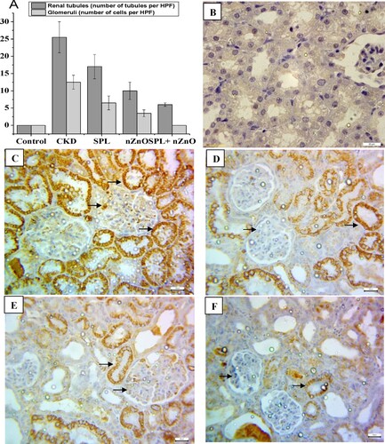 Figure 6. Immunohistopathological examination for α-SMA expression in kidney tissues. (A) The score of α-SMA in all studied groups, (B) negative expression for α-SMA (control group, 400×), (C) marked cytoplasmic expression for α-SMA in both renal tubules and glomeruli (CKD group, 200×), (D) moderate expression of α-SMA in SPL group (200×), (E) mild expression of α-SMA in ZnO-NPs group (200×), and (F) mild expression in SPL + ZnO-NPs group (200×). a: significant difference versus control, b: significant versus CKD, c: significant versus SPL, d: significant versus ZnO-NPs at p < 0.05.