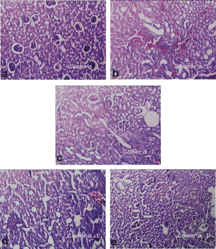 Figure 2.  Microscopic examination (H&E, ×50) of kidney section of (a) the control rats, (b) rats receiving EG 0.75% only, (c) rats receiving EG 0.75% and treated with cystone, (d) rats receiving EG 0.75% and AqE of B. ceiba fruit, and (e) rats receiving EG 0.75% and EtE of B. ceiba fruit.