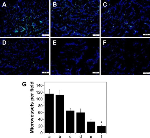 Figure 9 CD31 immunofluorescent staining of tumors.Notes: Representative CD31 immunofluorescent images of NS (A), NPs–hydrogel (B), free Doc (C), Doc NPs–hydrogel (D), free Doc+LL37 (E), Doc+LL37 NPs–hydrogel group (F), and MVD in each group (G) (a–f corresponding to [A–F], respectively), *P<0.05 indicates statistically differences from the NS group. Error bars represent standard deviation (n=6).Abbreviations: NS, normal saline; NPs, nanoparticles; Doc, docetaxel; MVD, microvessel density.