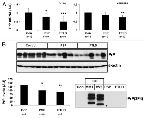 Figure 6. Expression of PrP in PSP and FTLD (fFTLD-tau and FTLD-TDP-43) frontal cortex. (A) mRNA average expression levels of PrP in the frontal cortex in control (Con), PSP and FTLD cases determined by TaqMan PCR assays. Values for PrP mRNA are normalized using GUSβ and XPNPEP1 as internal controls. (B) western blot analysis of PrP in the frontal cortex of control (Con), PSP and FTLD cases in five representative cases per condition; β-actin is used to normalize total protein loading. Densiometric values of all the cases analyzed by western blot: control (n = 7), PSP (n = 12) and FTLD (n = 7) show reduced PrP expression in PSP and FTLD. *P > 0.05; **P > 0.01; ***P > 0.001: control vs PSP/FTLD cases. (C) PK digestion of PSP and FTLD samples confirm that PSP and FTLD do not contain PrPsc.