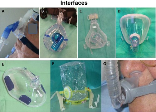 Figure 2 Interfaces for noninvasive ventilation.