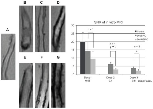 Figure 3 Graph showing the SNR of the aortic wall specimens on in vitro MRI scans.Notes: Aortic specimens from WHHL rabbits (A) Controls; (B) dose 1, (C) dose 2, (D) dose 3 of D-USPIO; (E) dose 1, (F) dose 2, (G) dose 3 of DM-USPIO (dose 1: n = 1; dose 2: n = 1; dose 3: n = 3). Compared to the controls, the signal from the aortic wall decreased in rabbits injected with D- or DM-USPIO, in a dose-dependent manner. At dose 3, the SNR tended to be lower (*P < 0.1) in rabbits treated with DM-USPIO. The SNR value obtained from three ROIs on three different aortic images was significantly lower (**P < 0.05) in the rabbit treated with dose 2 DM-USPIO than in the rabbit treated with an equivalent dose of D-USPIO. There was no significant difference at dose 1 (P > 0.1).Abbreviations: D-USPIO, dextran-coated ultrasmall superparamagnetic iron oxide; DM-USPIO, mannan–dextran-coated ultrasmall superparamagnetic iron oxide; SNR, signal-to-noise ratio; ROI, region of interest.