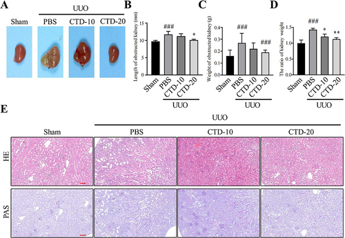 Figure 1 Effects of CTD on kidney of UUO-treated mice. (A) Representative pictures of kidney of mice after experiment, (B) kidney length, (C) kidney weight, (D) the ratio of kidney weight to contralateral non-obstructed kidney weight of experimental mice, (E) HE and PAS of histological structure of kidney in different groups, Scale bar: 100 μm; *P < 0.05, **P < 0.01, ###P < 0.001, compared to the UUO group, (n = 5 mice per group).
