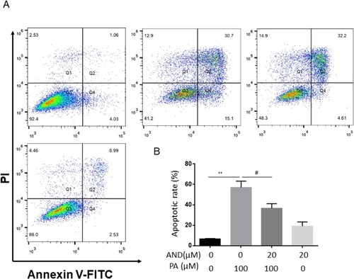 Figure 2 The effects of AdipoRon on PA-induced cell apoptosis in H9c2 myocardial cells. H9c2 myocardial cells were incubated with PA (100 μM) in the absence or presence of indicated concentrations of AdipoRon (20 μM) for 18 h. Specifically, in the combination group of the two, it was pretreated with AdipoRon half an hour and then incubated PA until to 18h. Apoptotic cells were defined by the flow cytometry (A). The values represent means ± SD from four separate experiments (B). **P<0.01, #P<0.05 vs PA treatment.