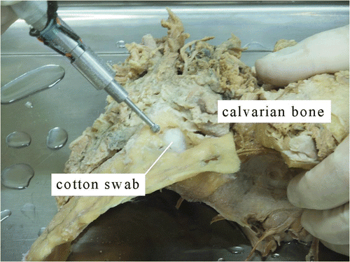 Figure 2. The experiment with calvarian bone.