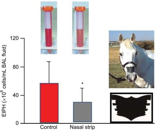 Figure 9 The nasal strip pictured at right significantly (*P<0.05) reduced exercise-induced pulmonary hemorrhage during high-intensity exercise as measured by bronchoalveolar lavage.