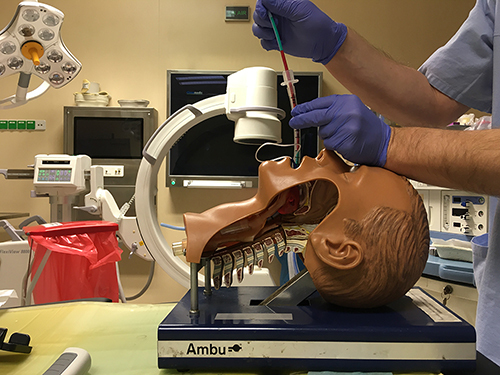 Figure 4 Introduction of endotracheal tube over Voir Bougie® after removal of the Vie Scope®.