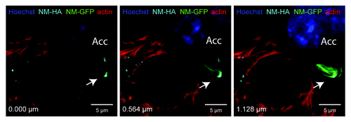Figure 2. NM-HA aggregates transmitted from N2a donor to acceptor cells (Acc) co-localize with induced NM-GFP aggregates. Confocal microscopy revealed the presence of NM-HA and NM-GFP aggregates in the same N2a cell. Donor cells with induced NM-HA aggregates were co-cultured with acceptor cells expressing soluble NM-GFP. Different layers of a Z-stack are shown (Z distance = 0.564 µm). NM-HA aggregates were stained with anti-HA antibody (light blue) and F-actin was stained with iFluor-546-Phalloidin (red). Nuclei were stained with Hoechst (blue) and NM-GFP is displayed in green. (Scale bar = 5 μm).