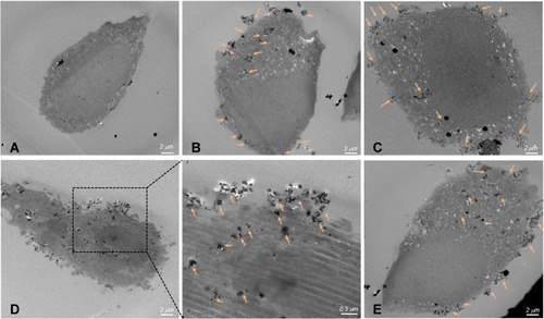 Figure 5 Thin-section TEM images of cell incubated with magnetic mesoporous silica nanoparticles. (A) Control cells without nanoparticles, (B) SP/C, (C) FS3P-G/C, (D) FS3P-A/C, and (E) FS3P-G-E/C. Arrows denote metal oxide particles or particulate matter.