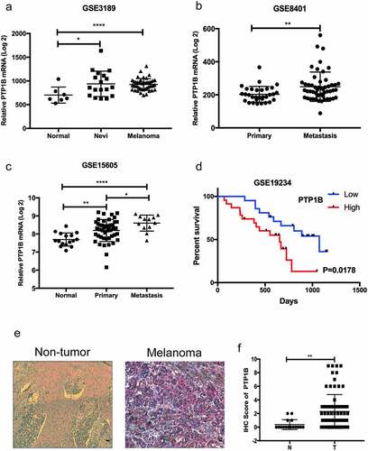 Figure 1. PTP1B expression is highly elevated in malignant melanoma and correlates with poor survival