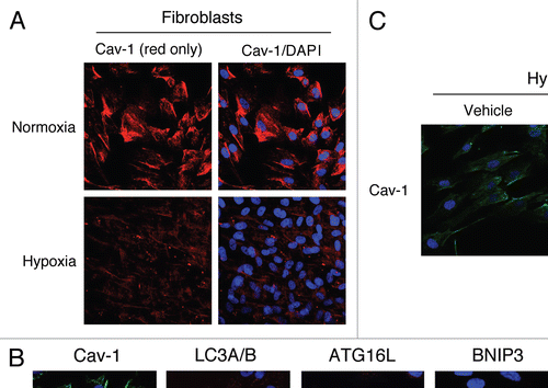 Figure 3 Hypoxia-induced autophagy drives Cav-1 degradation in fibroblasts: Rescue with chloroquine, an autophagy inhibitor. (A) Hypoxia decreases Cav-1 levels in homotypic fibroblasts. Homotypic cultures of hTERT-fibroblasts were placed in hypoxia (0.5% O2) or normoxia (21% O2) for three days. Then, cells were fixed and stained with anti-Cav-1 (red) antibodies and DAPI nuclear stain (blue). Cav-1 staining (red only) is shown at left to better appreciate the hypoxia-induced Cav-1 degradation. Original magnification, 40x. (B) Hypoxia-induced Cav-1 downregulation correlates with the expression of autophagic markers. hTERT-fibroblasts were subjected to hypoxia (0.5% O2, lower panels) or normoxia (21% O2, upper panels) for 48 hours. Then, the cells were fixed and stained with antibodies against either Cav-1 (green) or the indicated autophagic markers (red). DAPI was used to stain nuclei (blue). Note that hypoxia induces Cav-1 downregulation, while promoting autophagy. Original magnification, 80x. (C) The autophagy inhibitor chloroquine rescues the hypoxia-induced downregulation of Cav-1. To block hypoxia-induced Cav-1 degradation, hTERT-fibroblasts were subjected to hypoxia in the presence of the autophagic inhibitor chloroquine (25 µM) or vehicle alone control (H2O) for 24 hours. Then, cells were fixed and stained with anti-Cav-1 (green) antibodies and DAPI nuclear stain (blue). Note that chloroquine treatment prevents the hypoxia-induced degradation of Cav-1, as compared with control cells. Original magnification, 60x.