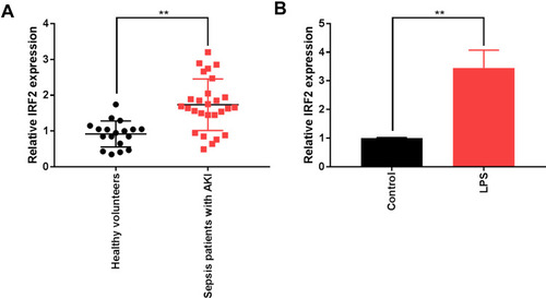 Figure 1 IRF2 expression is upregulated in the serum of S-AKI patients and cells. (A) The mRNA level of IRF2 in the serum of of S-AKI patients and healthy individuals was measured by qRT-PCR. (B) The mRNA level of IRF2 in LPS-induced HK-2 cells was detected by qRT-PCR. Data were expressed as mean + SD. **p<0.01.